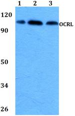 OCRL Polyclonal Antibody