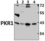 Prokineticin Receptor 1 Polyclonal Antibody
