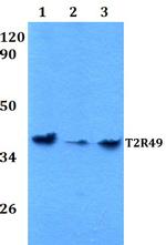 TAS2R20 Polyclonal Antibody