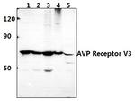 AVPR1B Polyclonal Antibody