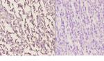 HCCS Polyclonal Antibody