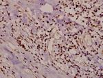 HSPB2 Polyclonal Antibody