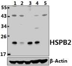 HSPB2 Antibody in Western Blot (WB)