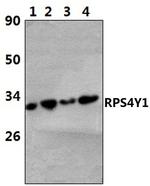 RPS4Y1 Polyclonal Antibody