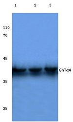 A4GNT Polyclonal Antibody