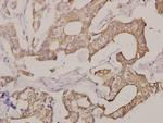 Apolipoprotein L1 Polyclonal Antibody