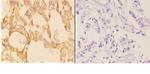 ABCB10 Polyclonal Antibody