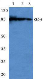 CLCN4 Polyclonal Antibody