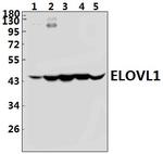 ELOVL1 Polyclonal Antibody