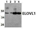 ELOVL1 Antibody in Western Blot (WB)