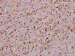 KDELR2 Polyclonal Antibody