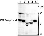 AVPR2 Polyclonal Antibody