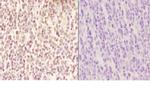 Myeloid Specific Antigen Antibody in Immunohistochemistry (Paraffin) (IHC (P))