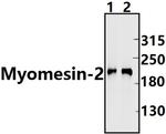 MYOM2 Polyclonal Antibody