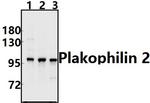 PKP2 Polyclonal Antibody