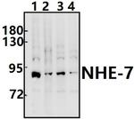 SLC9A7 Polyclonal Antibody
