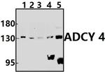 Adenylate Cyclase 4 Polyclonal Antibody