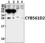 CYB561D2 Polyclonal Antibody