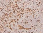 DEFA4 Polyclonal Antibody
