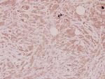 DEFA1 Polyclonal Antibody