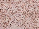 CCK Polyclonal Antibody