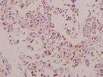 Cathepsin H Polyclonal Antibody