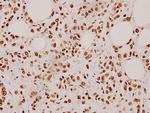 Cardiotrophin 1 Polyclonal Antibody