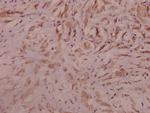 SEMA3A Polyclonal Antibody
