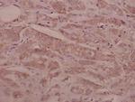 SEMA3C Polyclonal Antibody