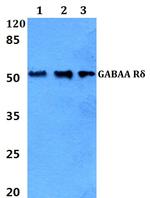 GABRD Polyclonal Antibody