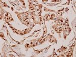 MRPS36 Polyclonal Antibody