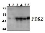 PDK2 Polyclonal Antibody