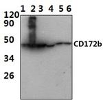 SIRPB1 Polyclonal Antibody