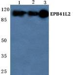 EPB41L2 Polyclonal Antibody