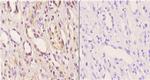 ABCD4 Polyclonal Antibody