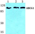 ABCG1 Polyclonal Antibody