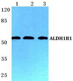 ALDH1B1 Polyclonal Antibody