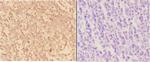 Arp3 Antibody in Immunohistochemistry (Paraffin) (IHC (P))