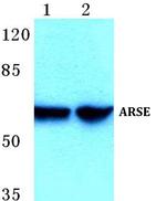 Arylsulfatase E Polyclonal Antibody