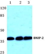BNIP2 Polyclonal Antibody