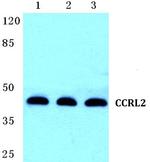 CCRL2 Polyclonal Antibody
