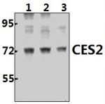 CES2 Polyclonal Antibody