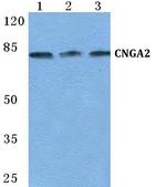 CNGA2 Polyclonal Antibody