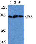 CPN2 Polyclonal Antibody