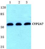 CYP2A7 Antibody in Western Blot (WB)