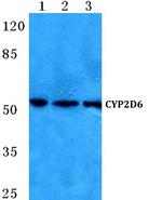 CYP2D6 Polyclonal Antibody