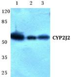 CYP2J2 Polyclonal Antibody