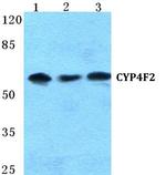 CYP4F2 Polyclonal Antibody