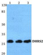 DHRS2 Polyclonal Antibody