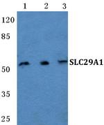 ENT1 Polyclonal Antibody